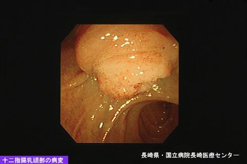 ID:4937