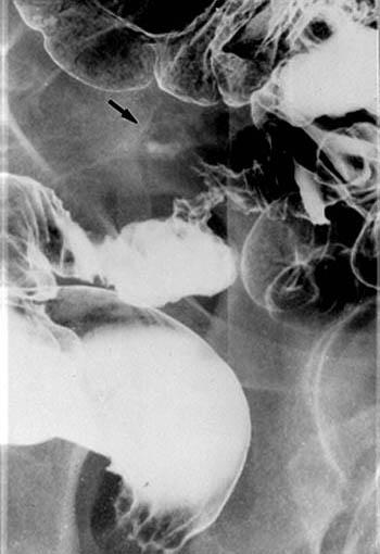 ID:1977