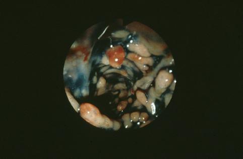 ID:2838