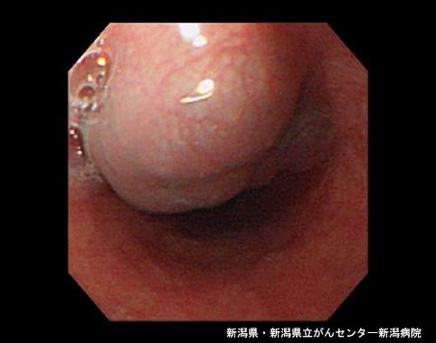 ID:4542