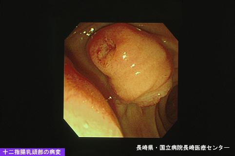 ID:4935