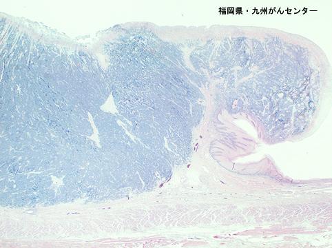 ID:5291
