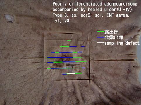 ID:10679