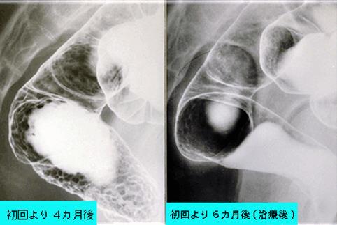 画像ID:992