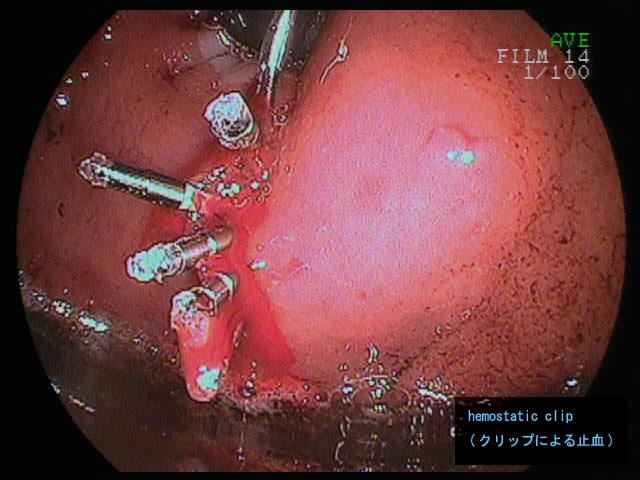 画像ID:2991