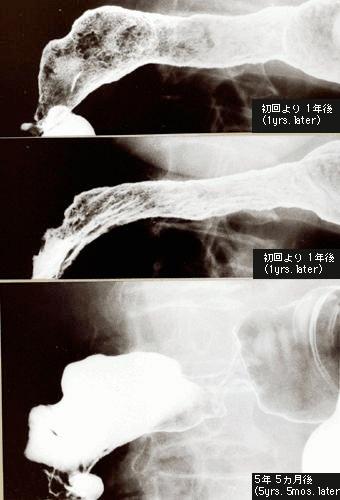 画像ID:543