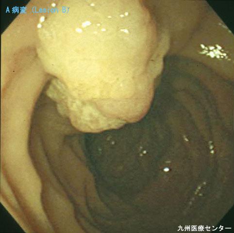 画像ID:3138