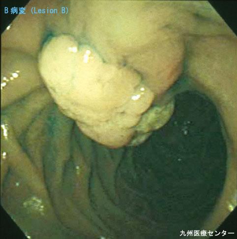 画像ID:3139