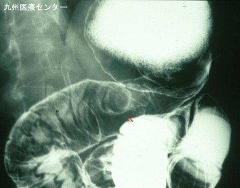画像ID:3148