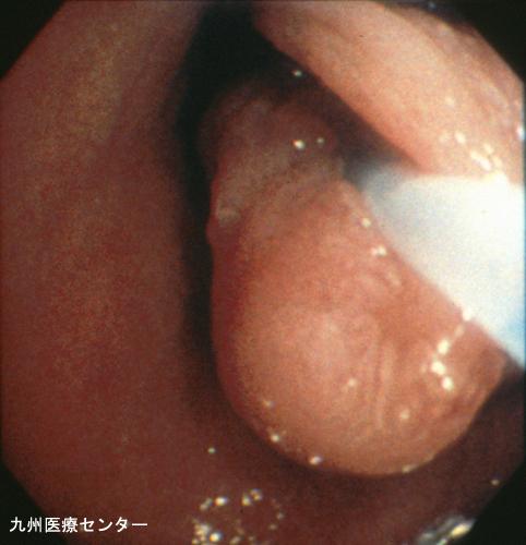 画像ID:3153