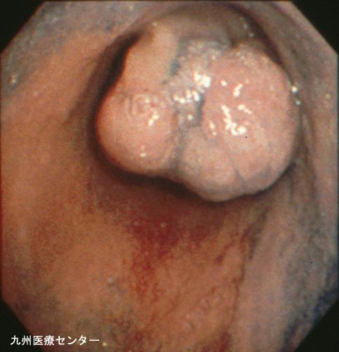 画像ID:3154