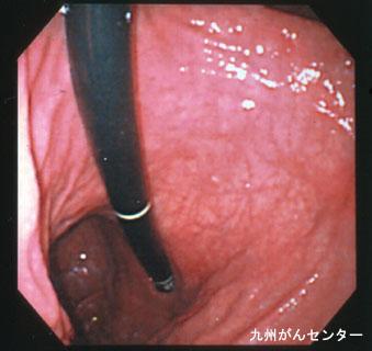 画像ID:3188