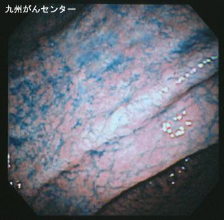 画像ID:3190