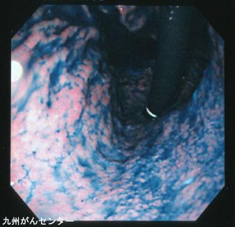 画像ID:3193
