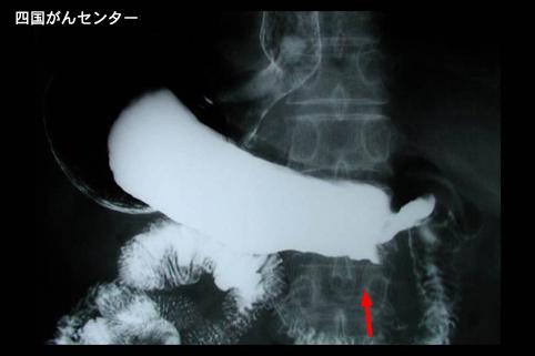 画像ID:3299