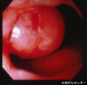 画像ID:3389