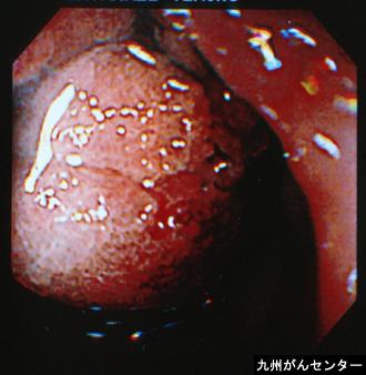 画像ID:3390
