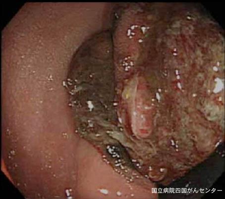 画像ID:2538