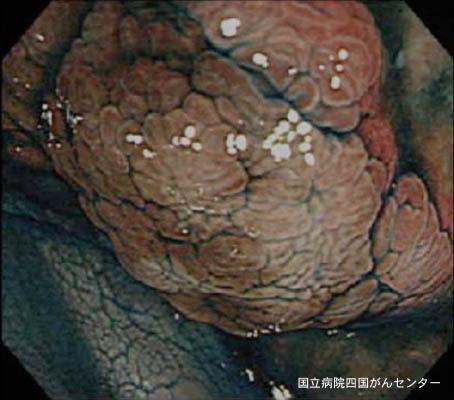 画像ID:2545