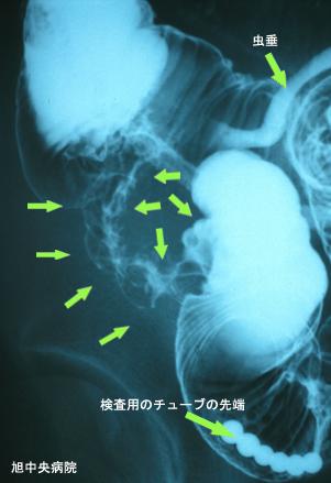 画像ID:3490