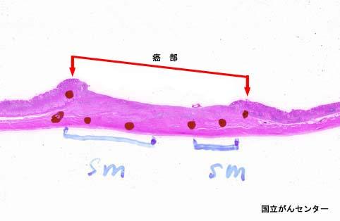 画像ID:3570