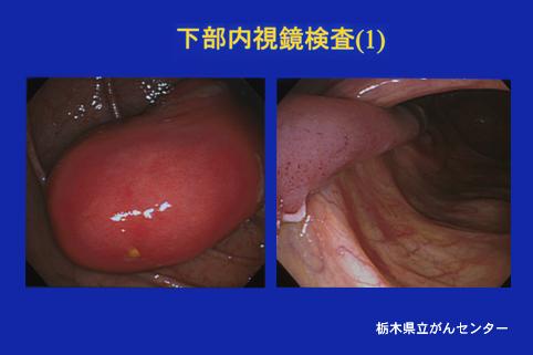 画像ID:3576
