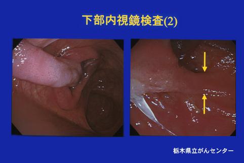 画像ID:3577