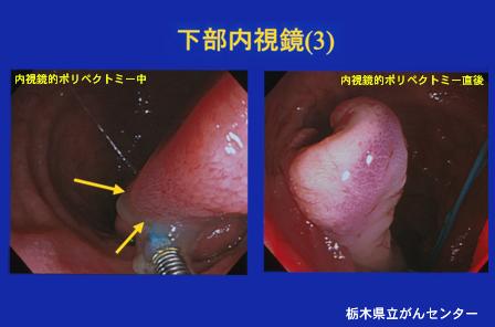 画像ID:3578