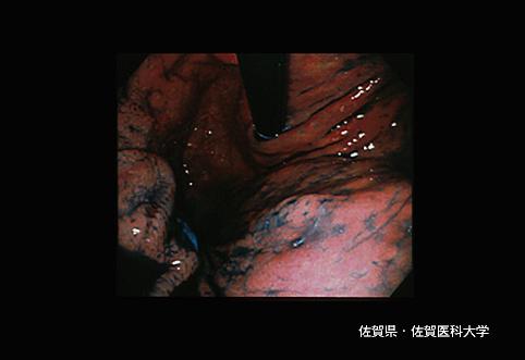 画像ID:3664