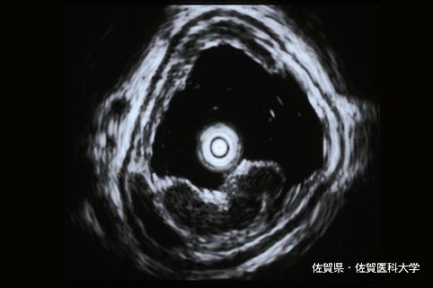 画像ID:3725