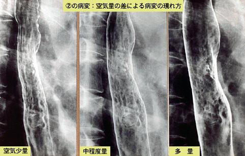 画像ID:3881