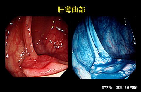 画像ID:3954