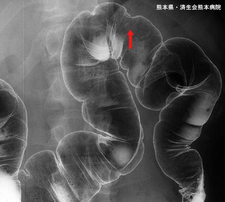 画像ID:4062