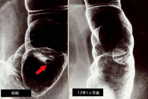 画像ID:1174