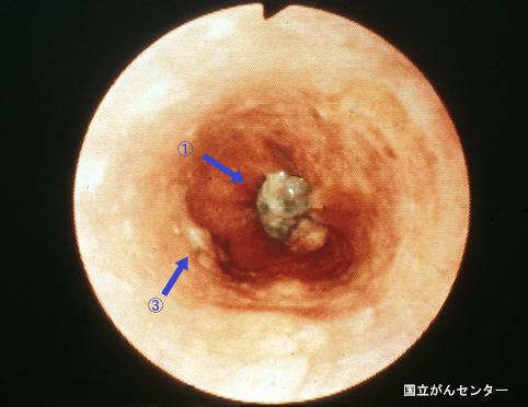 画像ID:4137