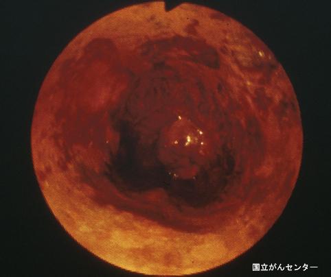 画像ID:4143