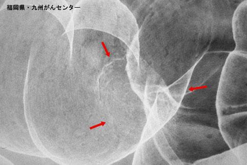 画像ID:4165