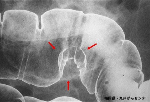 画像ID:4167