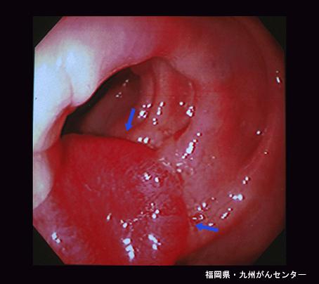 画像ID:4169