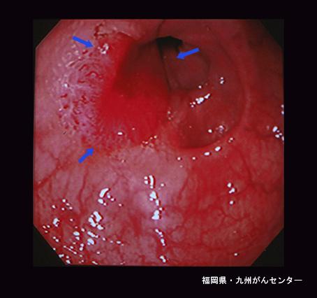 画像ID:4170