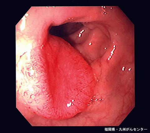 画像ID:4171