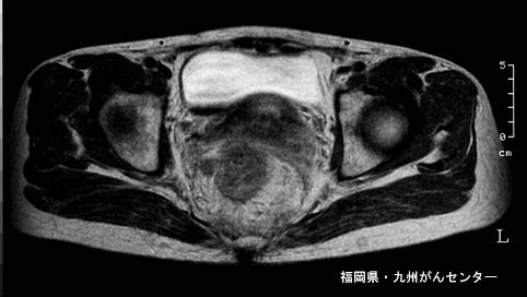画像ID:4241