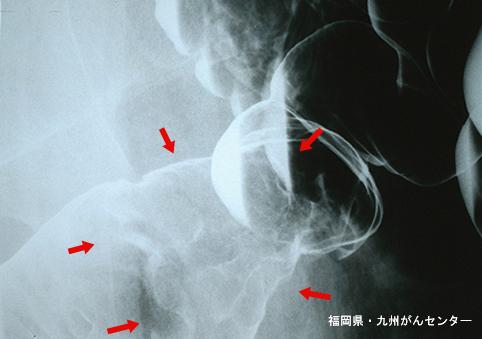 画像ID:4252