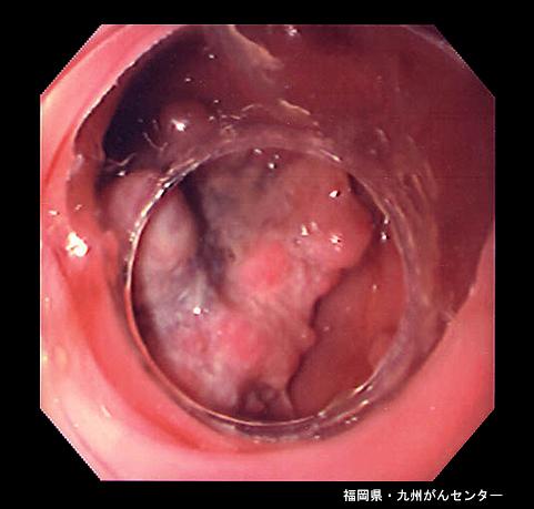 画像ID:4255