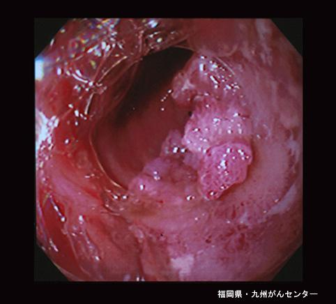 画像ID:4256