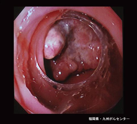画像ID:4257