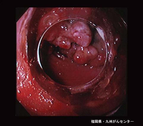 画像ID:4258