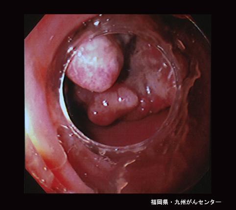 画像ID:4259