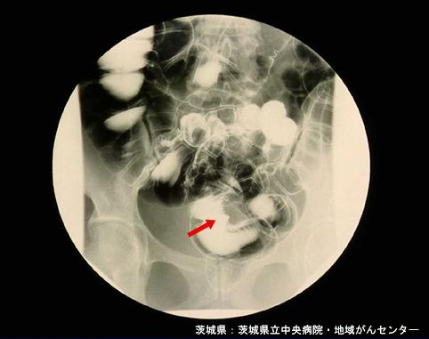 画像ID:4271