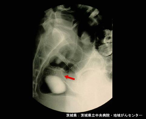 画像ID:4273